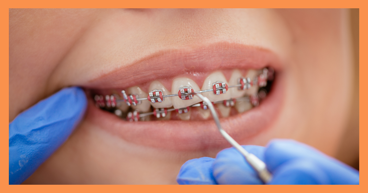 orthodontist in Gurgaon