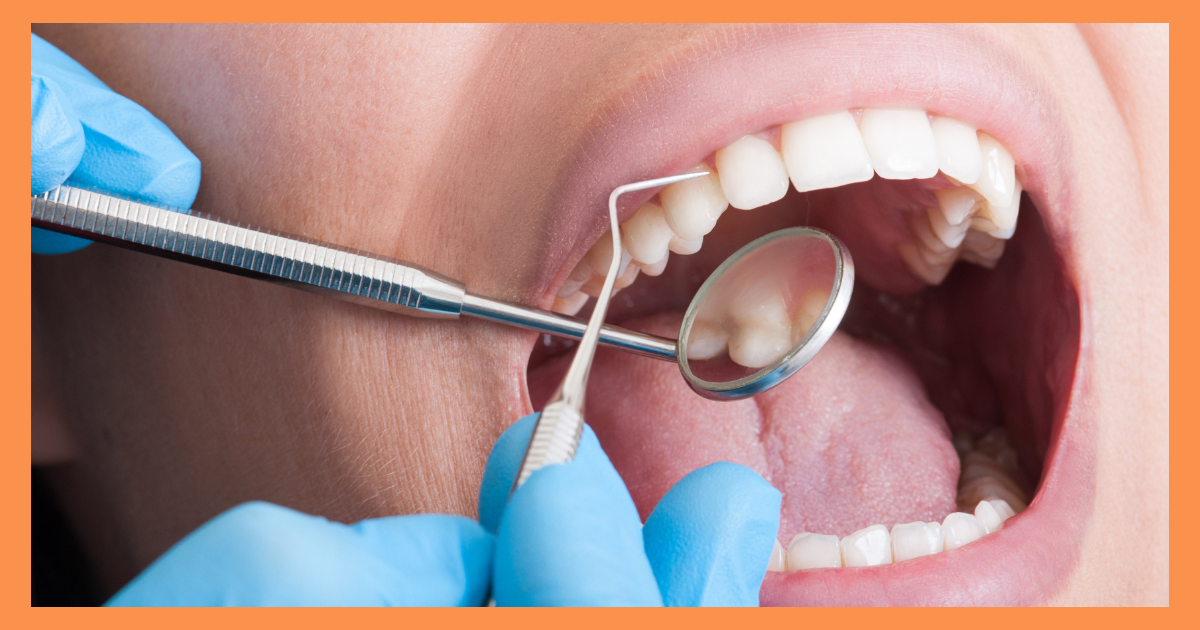 Dentist in Gurgaon