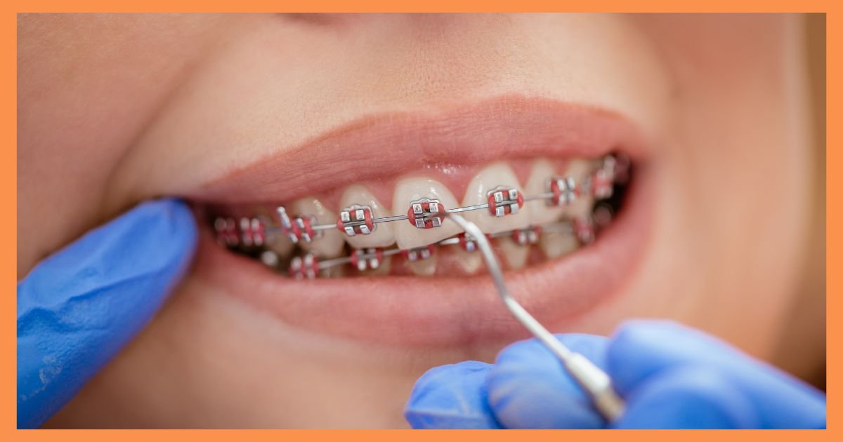 orthodontist in Gurgaon