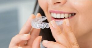 Aligners in Gurgaon