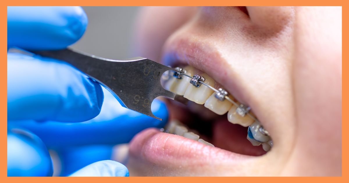 orthodontist in Gurgaon