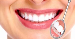 smile makeover in Gurgaon