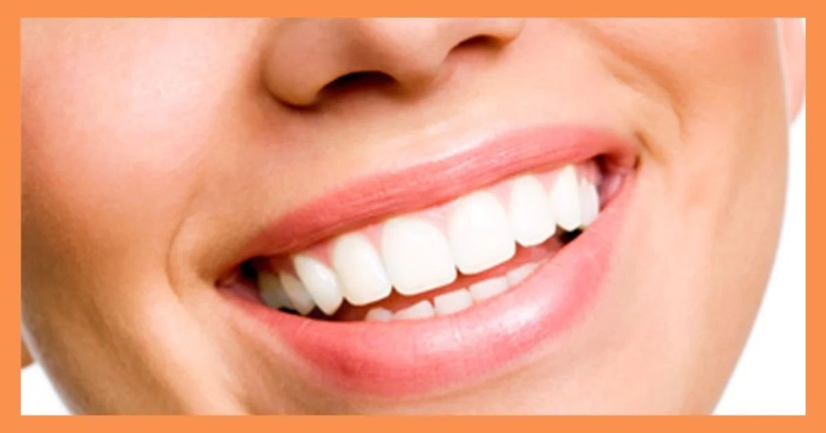 smile makeover in Gurgaon
