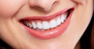 smile makeover in Gurgaon