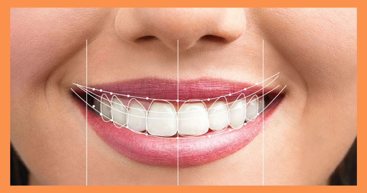 smile makeover in Gurgaon