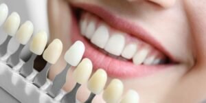 aesthetic dentist in Gurgaon