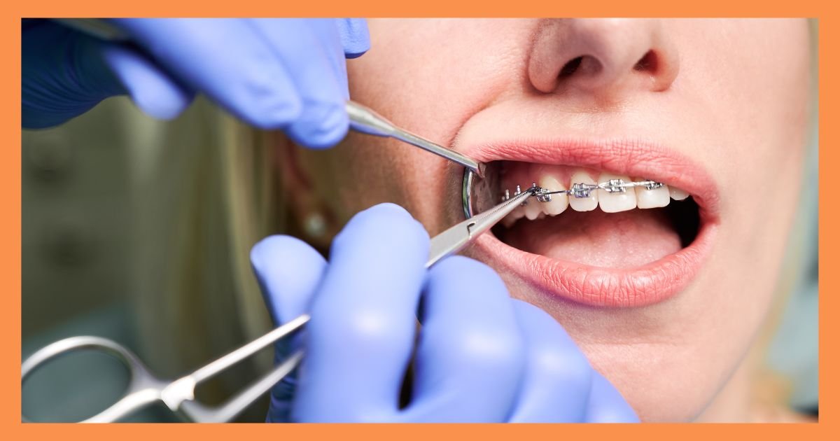 orthodontist in Gurgaon