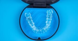 Aligners in Gurgaon