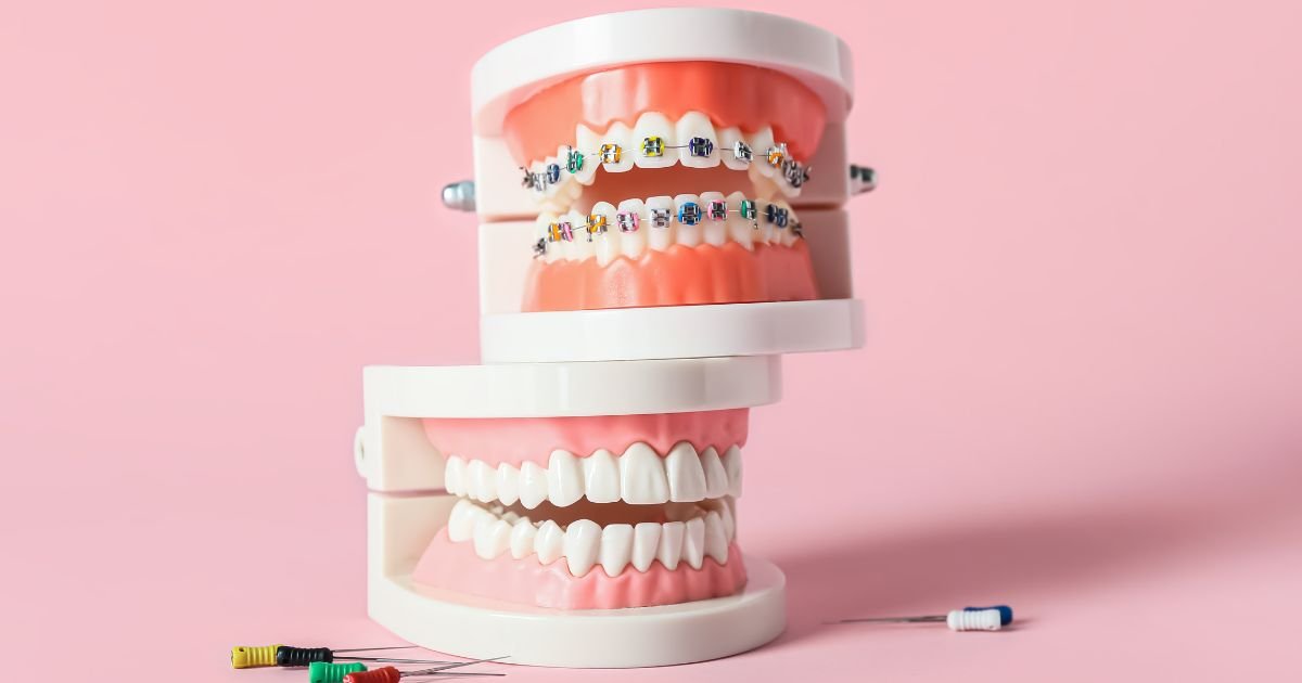 Orthodontics in Gurgaon
