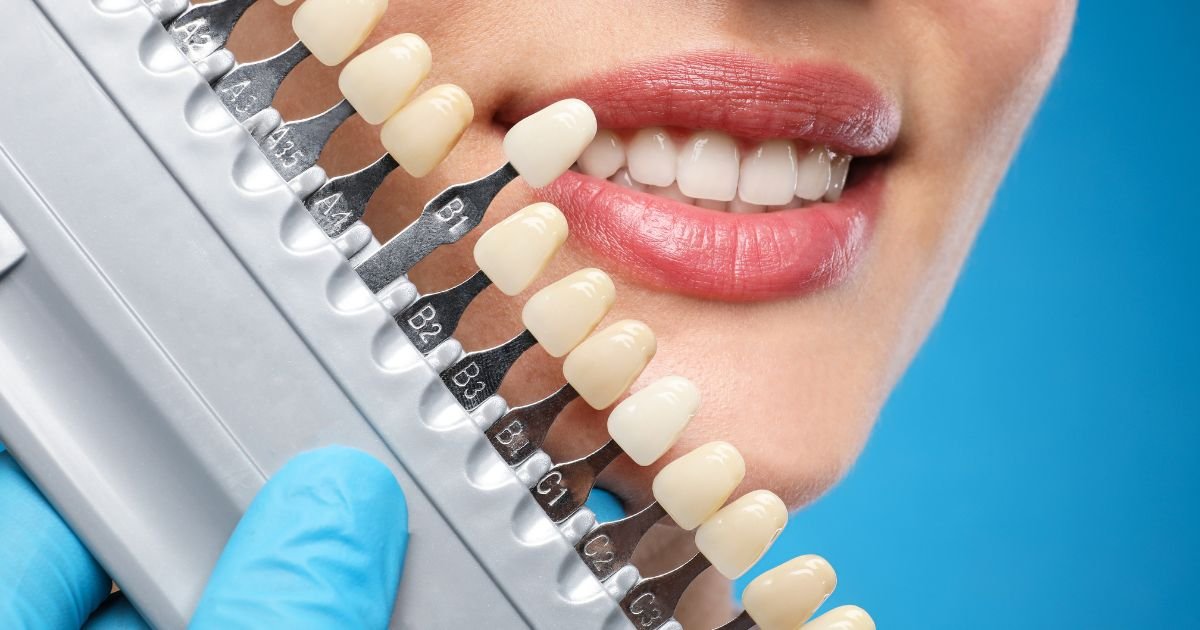 Aesthetic Dentistry in Gurgaon