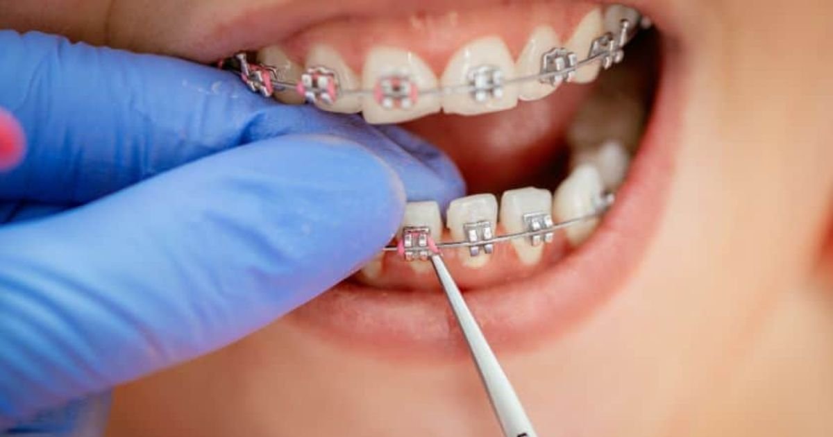orthodontist in Gurgaon