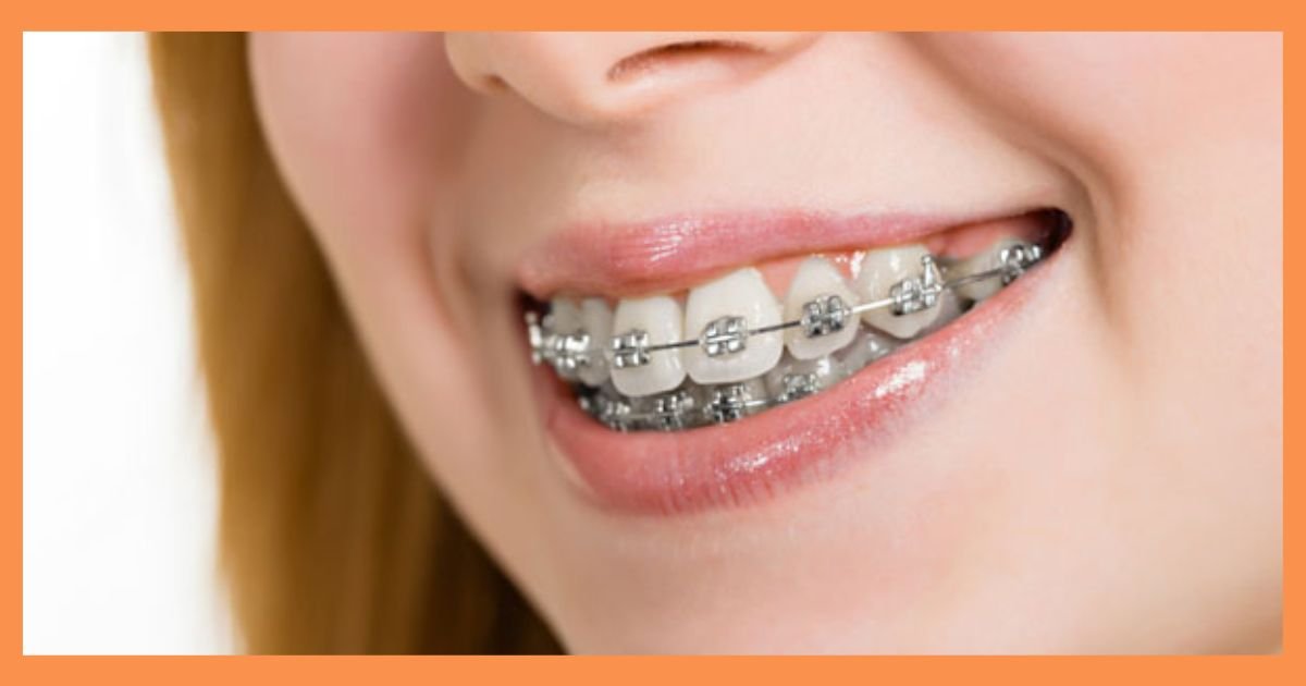 orthodontist in Gurgaon