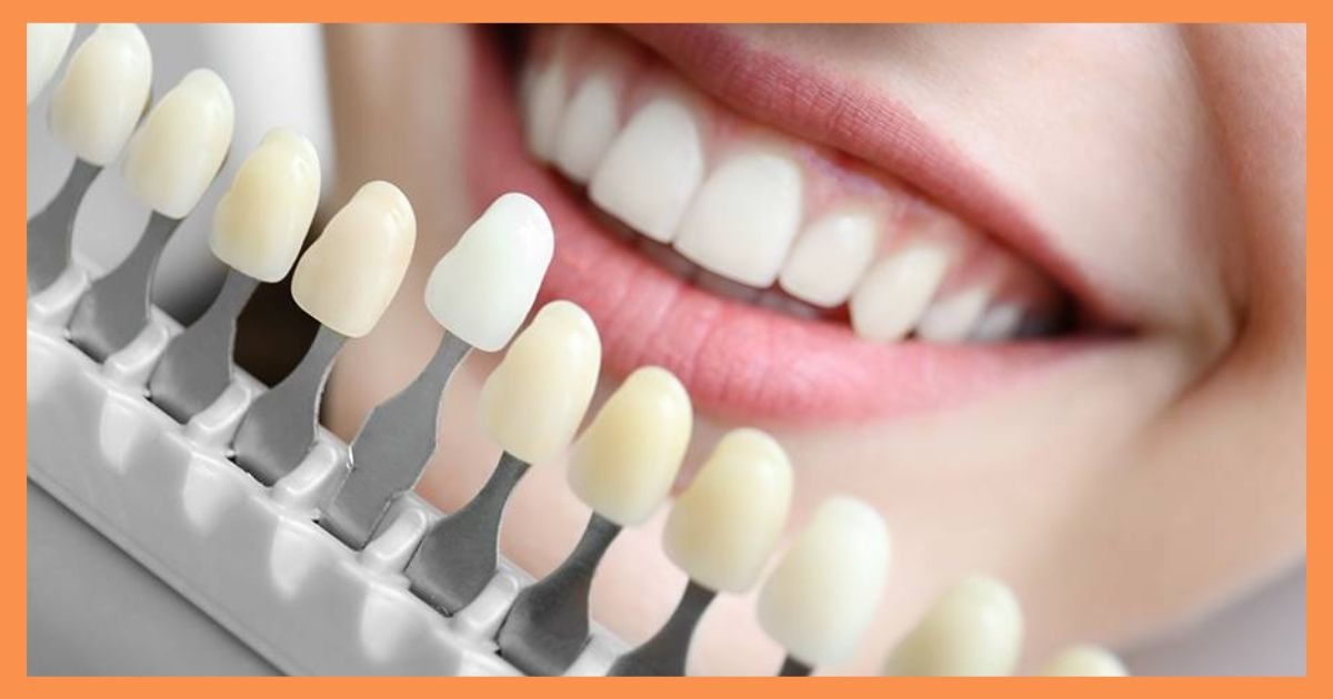Cosmetic Dentist in Gurgaon