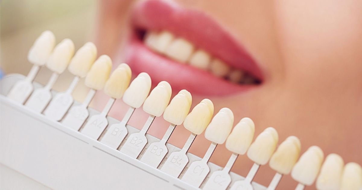 Cosmetic Dentist in Gurgaon