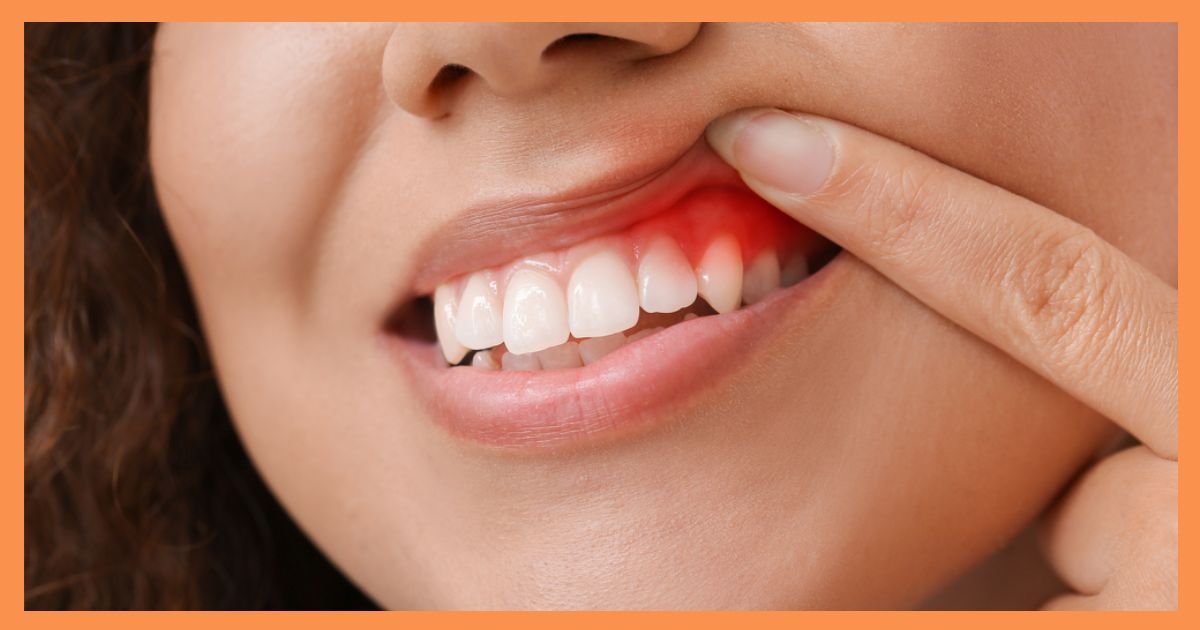 Dentist in Gurgaon