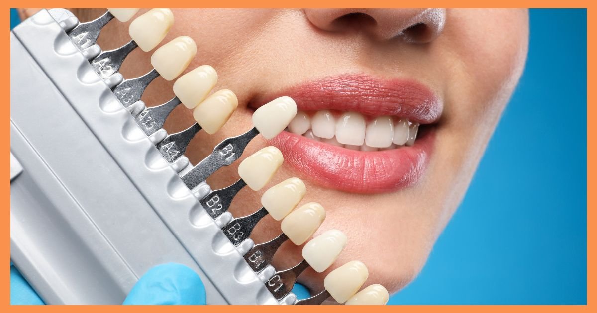 Aesthetic Dentistry in Gurgaon
