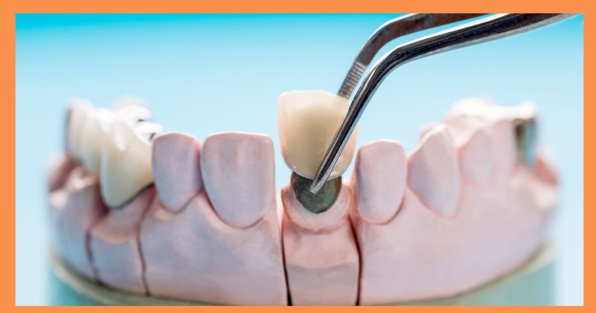 prosthodontist in gurgaon