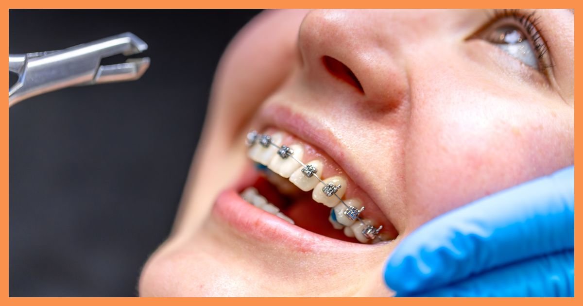 orthodontist in Gurgaon