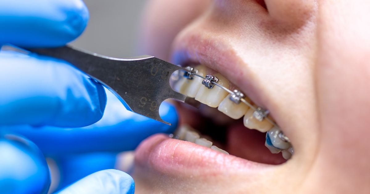 orthodontist in Gurgaon