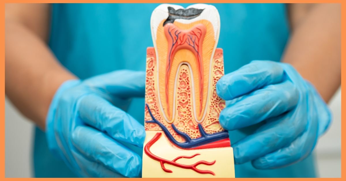 Root Canal Treatment in Gurgaon