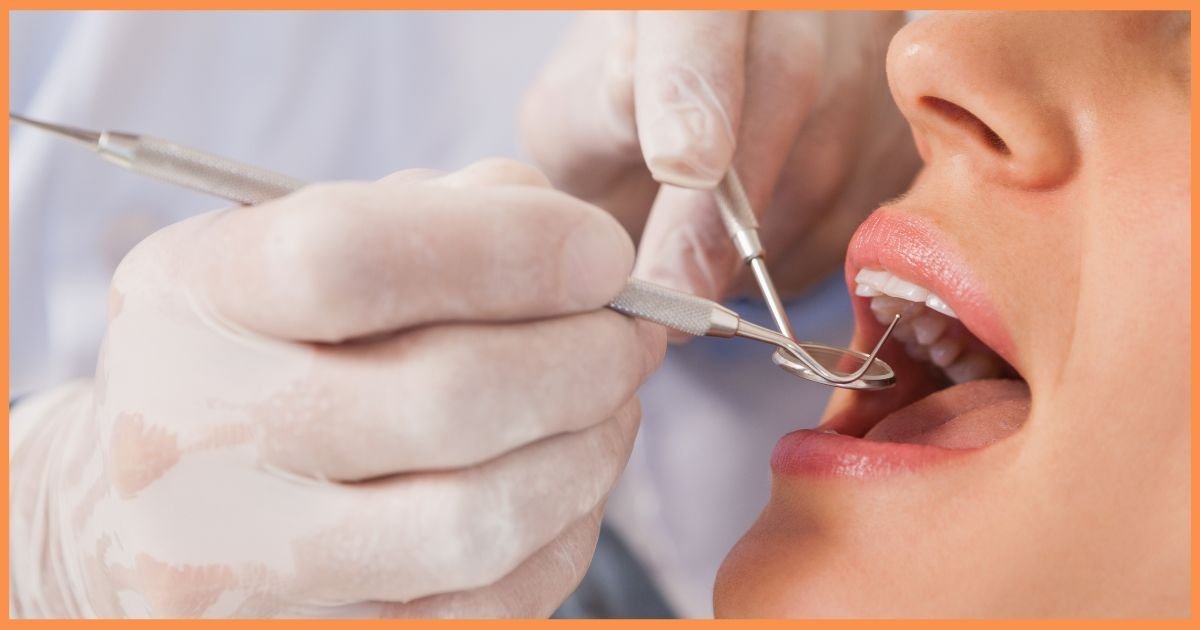 Aesthetic Dentistry in Gurgaon