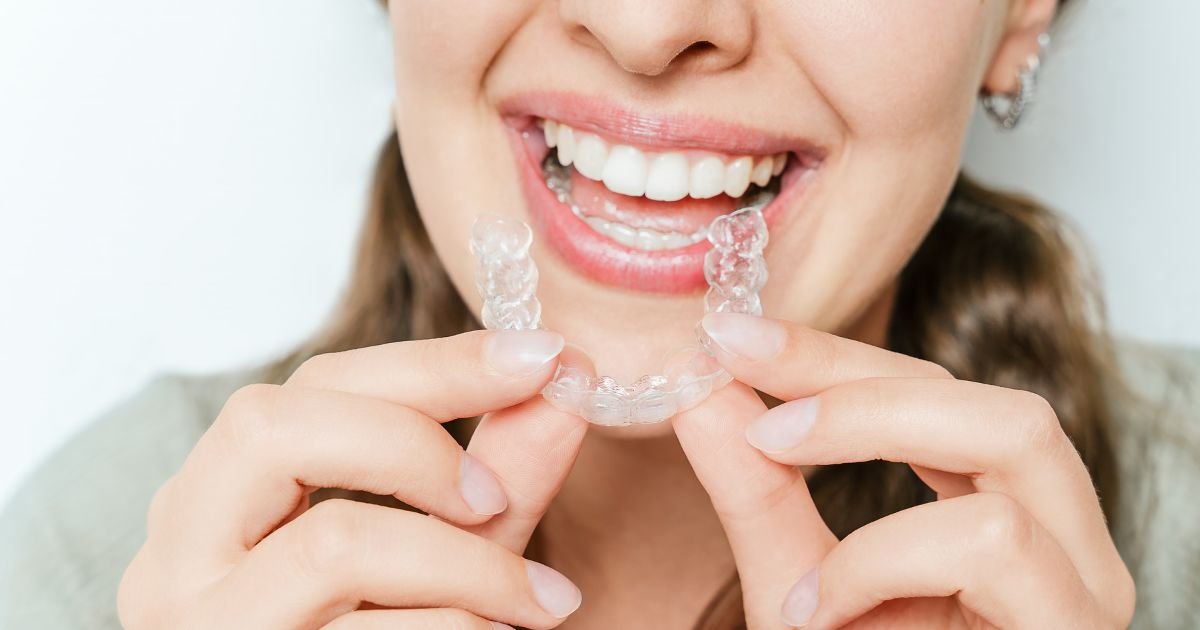 Invisalign clear aligners