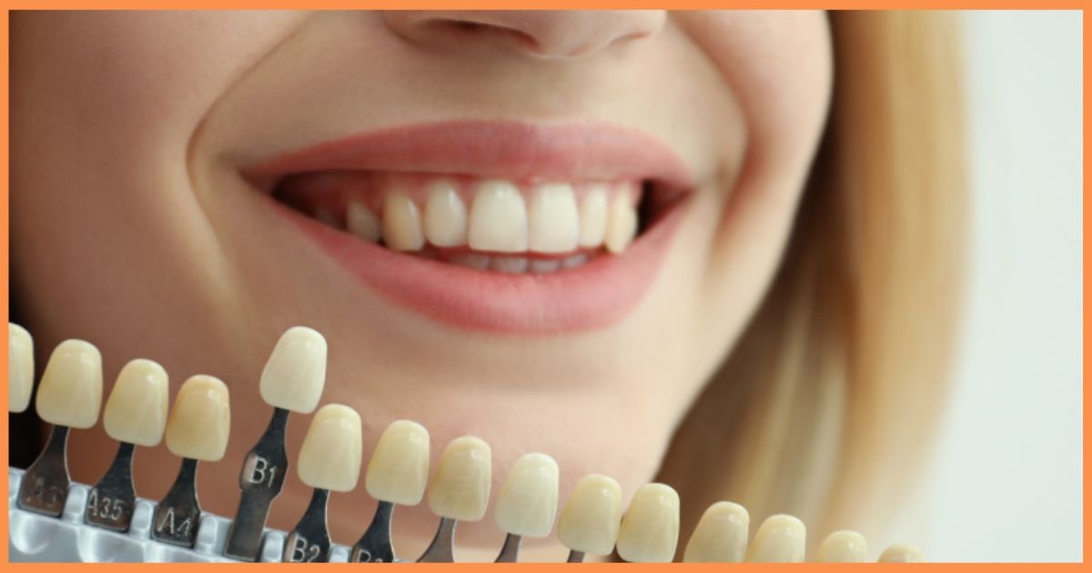 Aesthetic dentist in Gurgaon