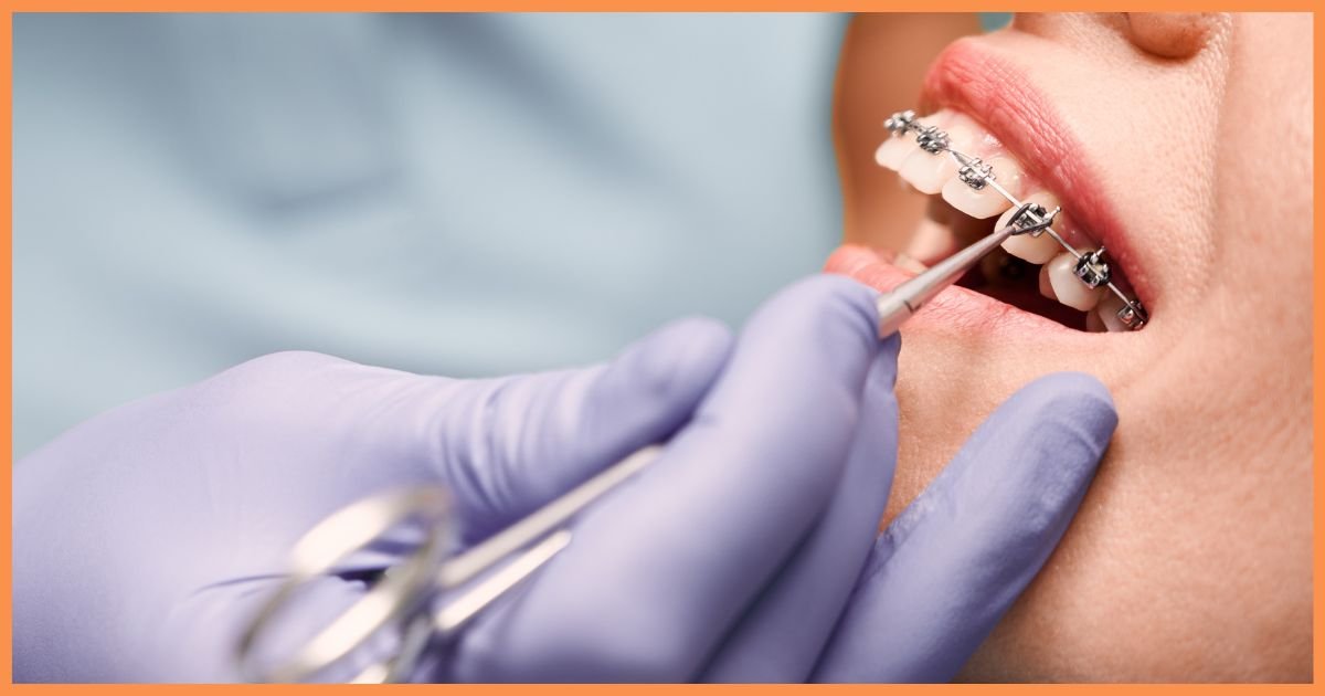 orthodontist in Gurgaon