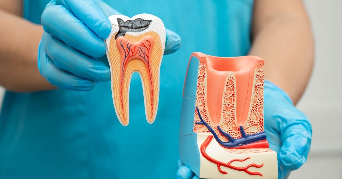 Root Canal Treatment in Gurgaon