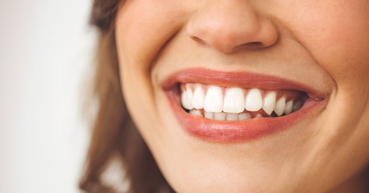 smile makeover in Gurgaon