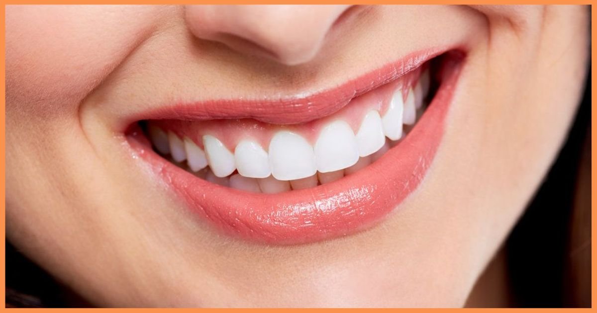 Smile makeover in Gurgaon