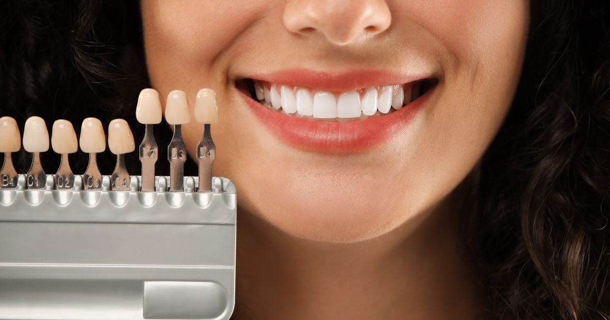 Aesthetic Dentistry