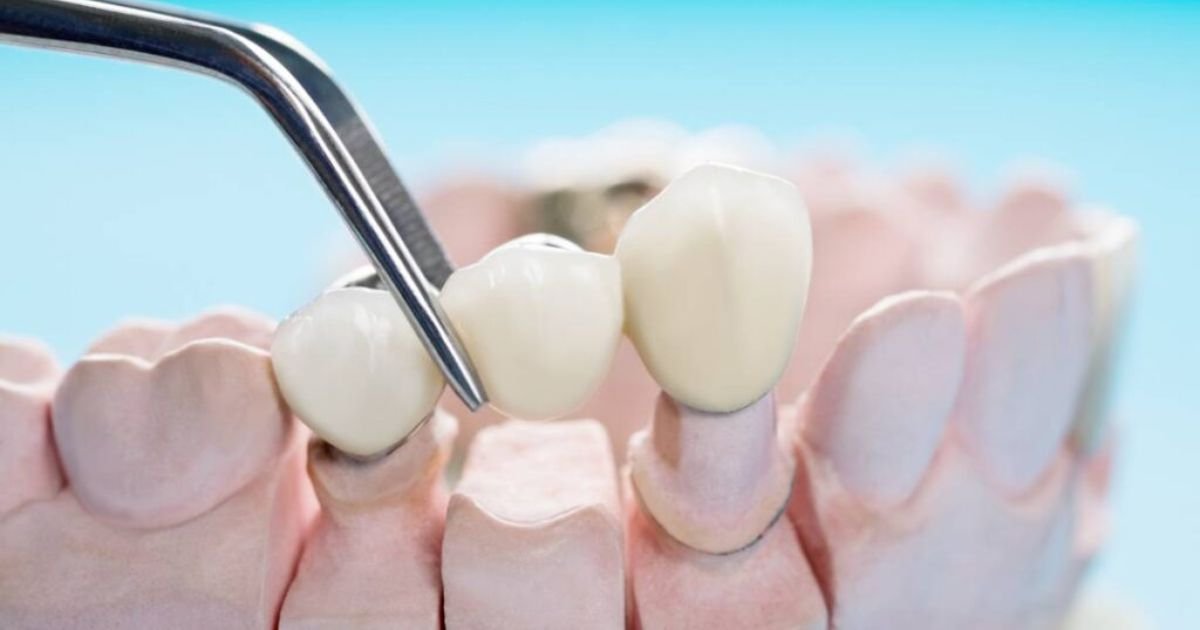 Prosthodontist in Gurgaon