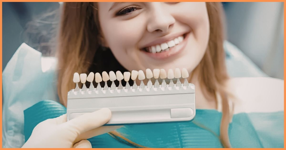 Smile Makeover
