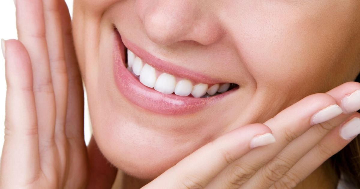 Smile Makeover