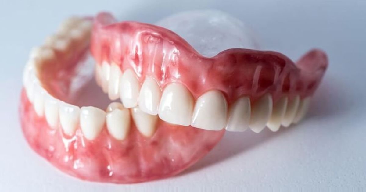 Dentures in Gurgaon