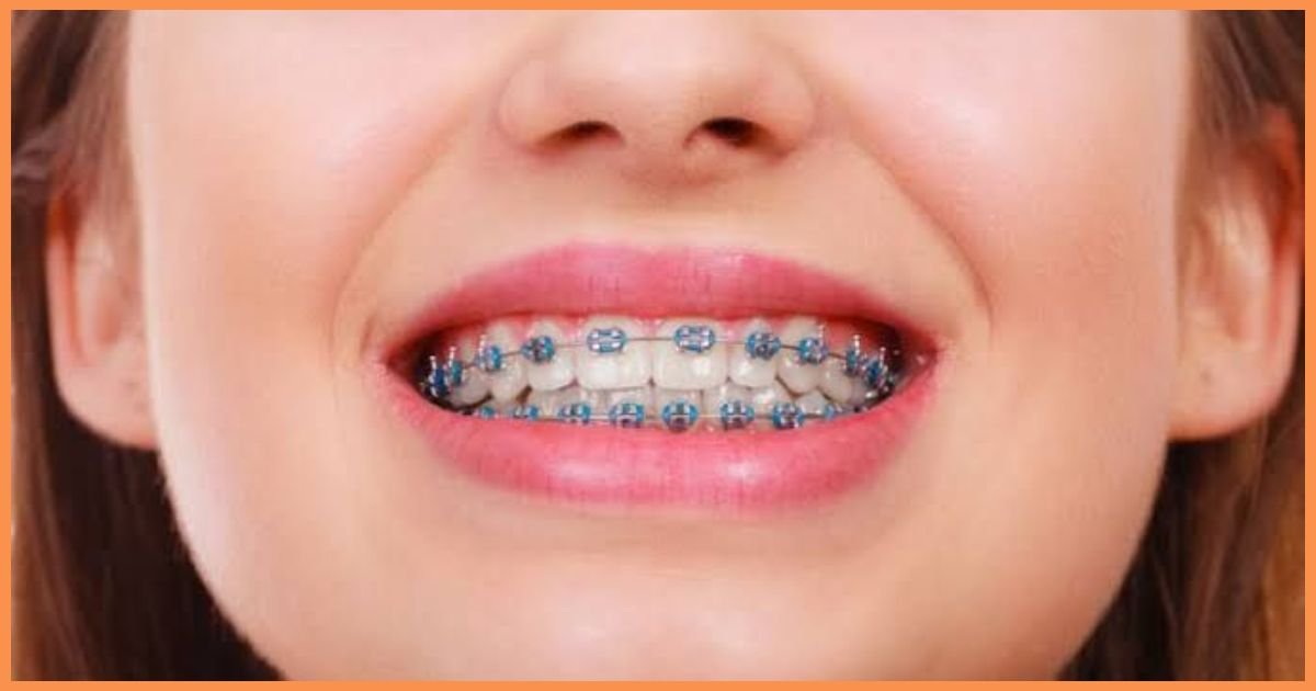 orthodontist in Gurgaon