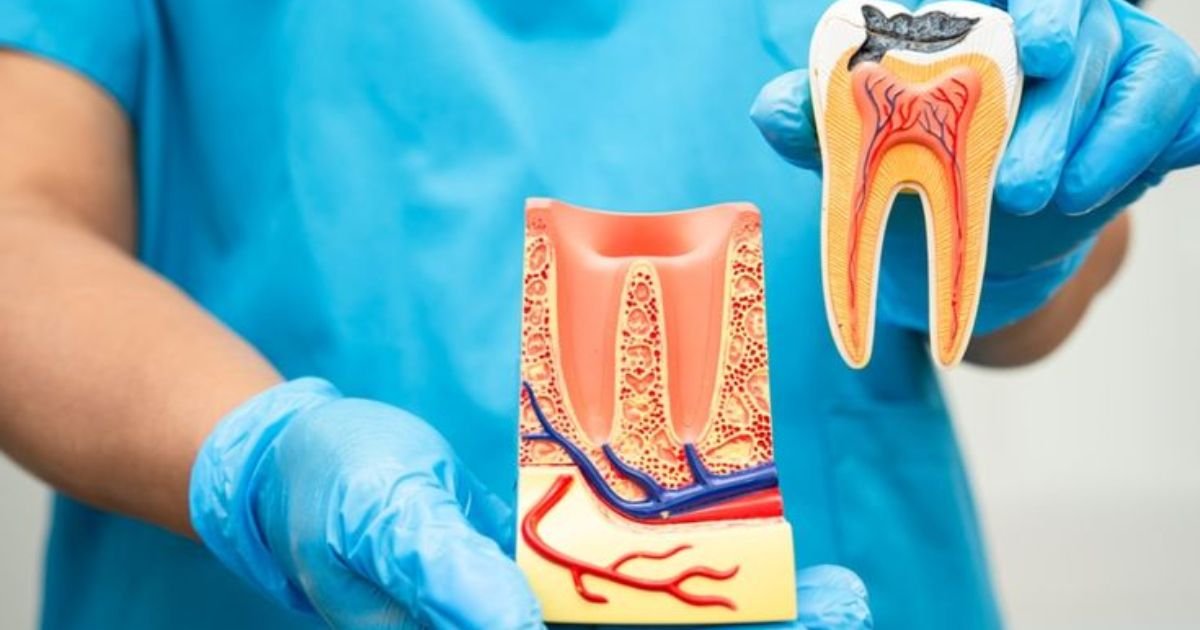 Root Canal Treatment