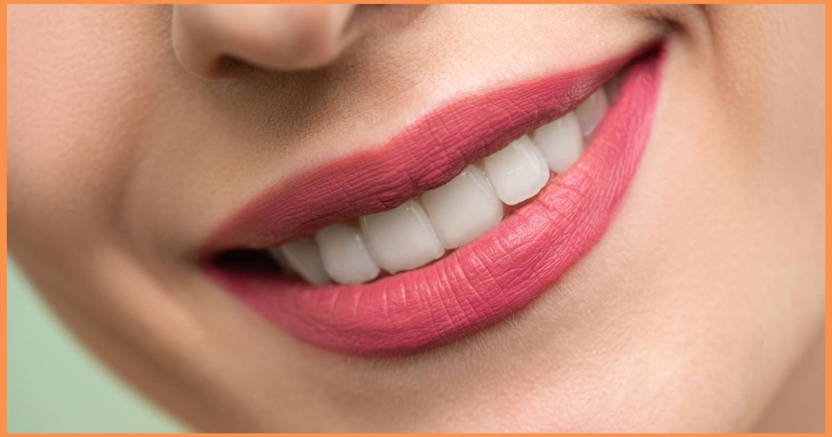 Smile Makeover in Gurgaon