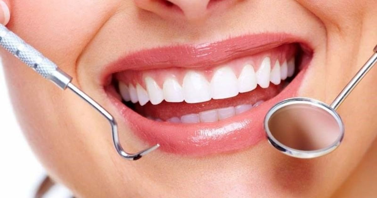 Smile Makeover