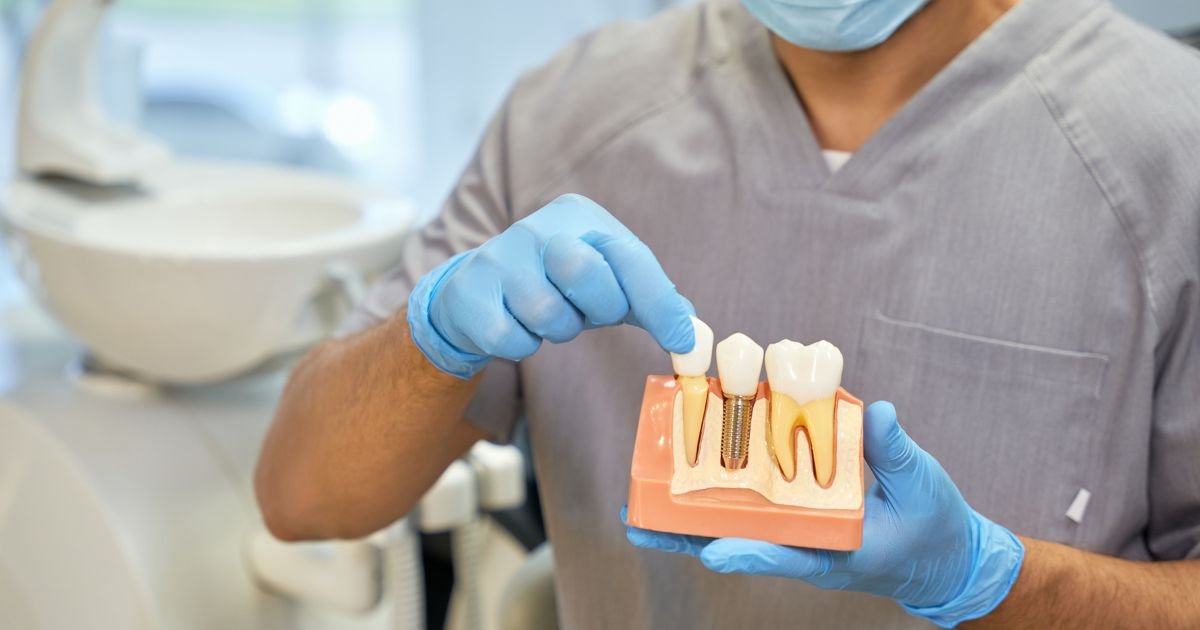 Implantologist in Gurgaon