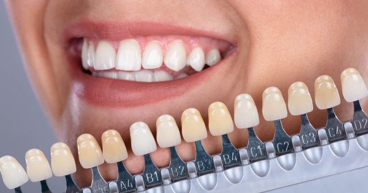 Aesthetic Dentist 