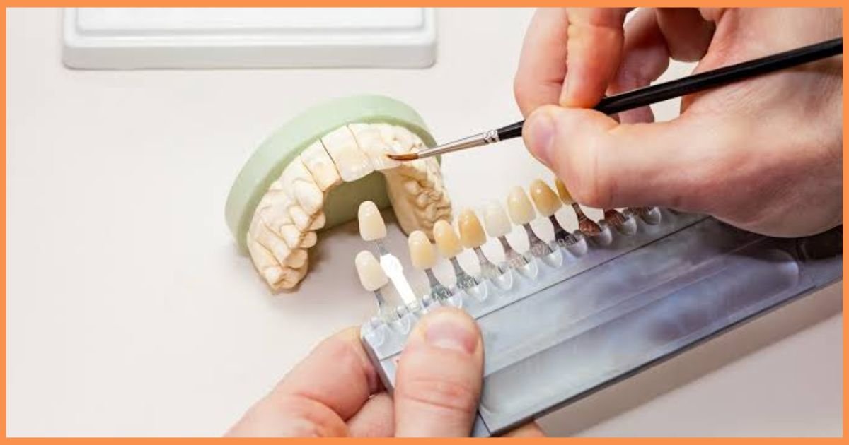 Aesthetic Dentist in Gurgaon