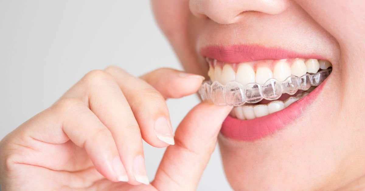 Invisalign Specialist