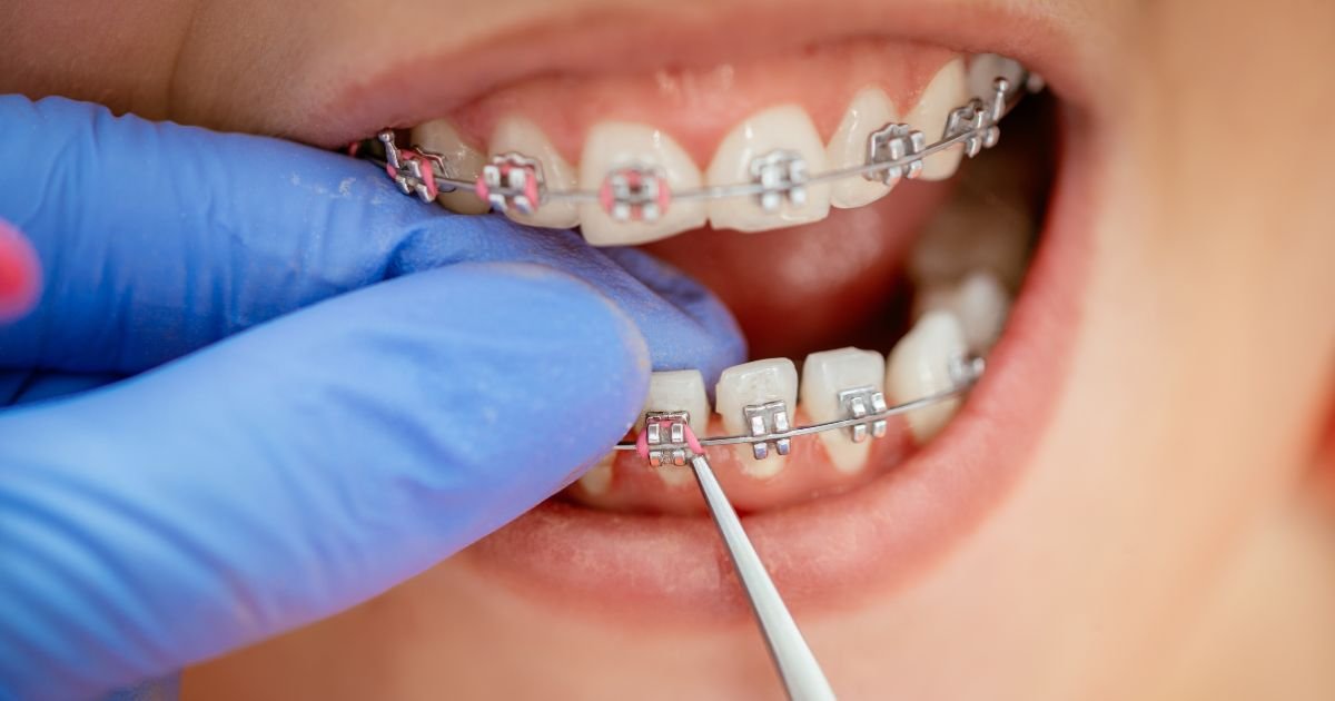 Orthodontist