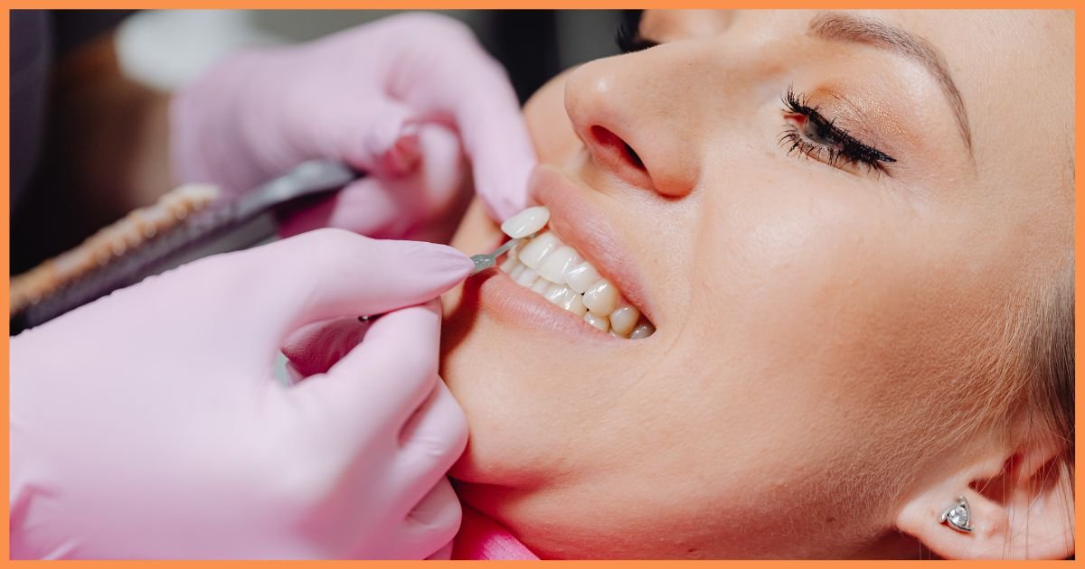 Veneers Treatment