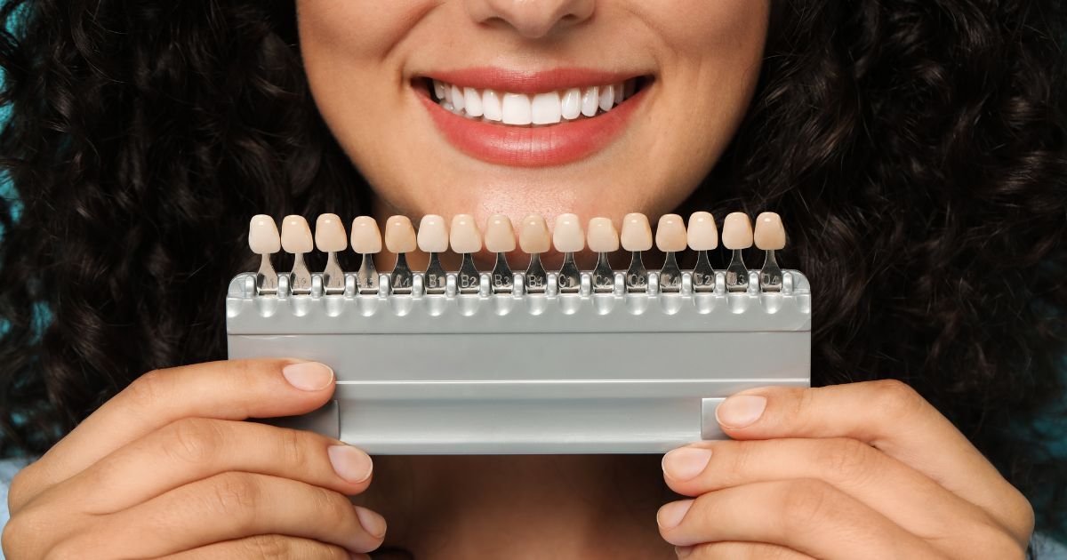 Veneers Treatment