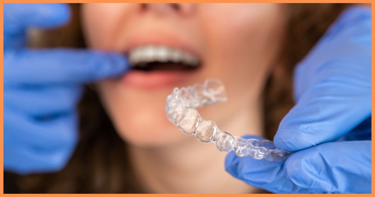 Invisalign