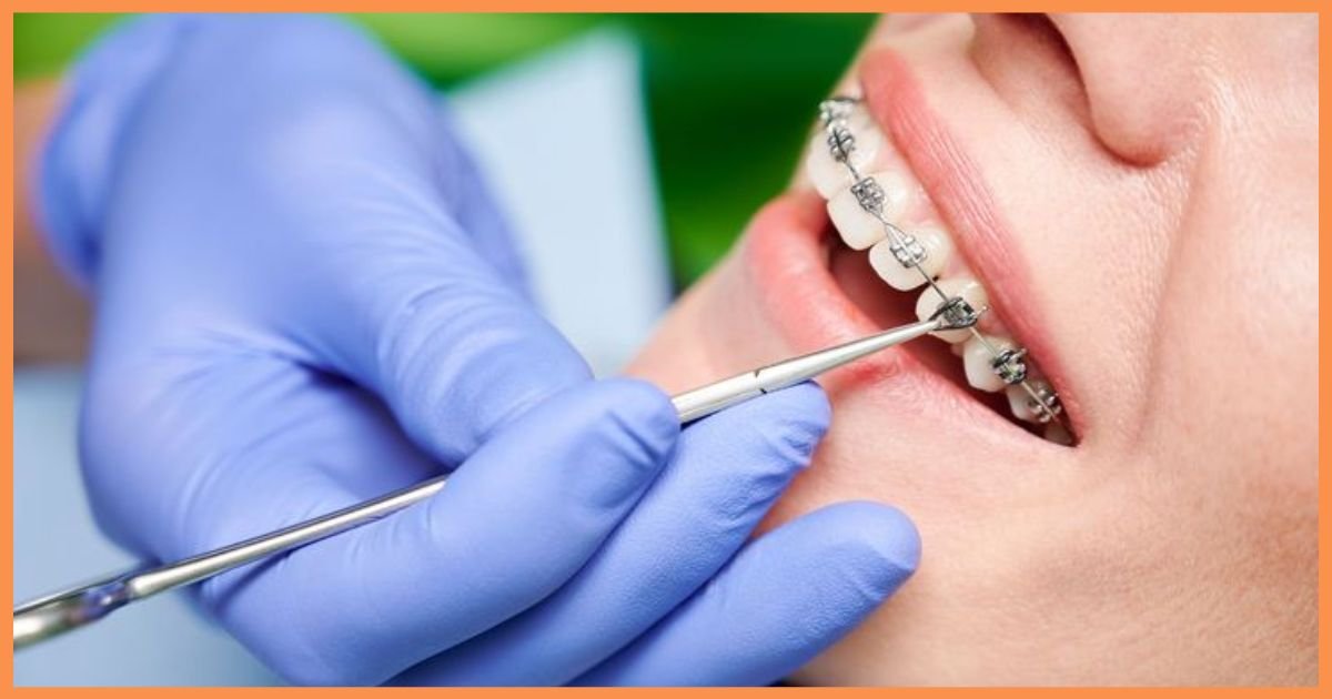 Orthodontist