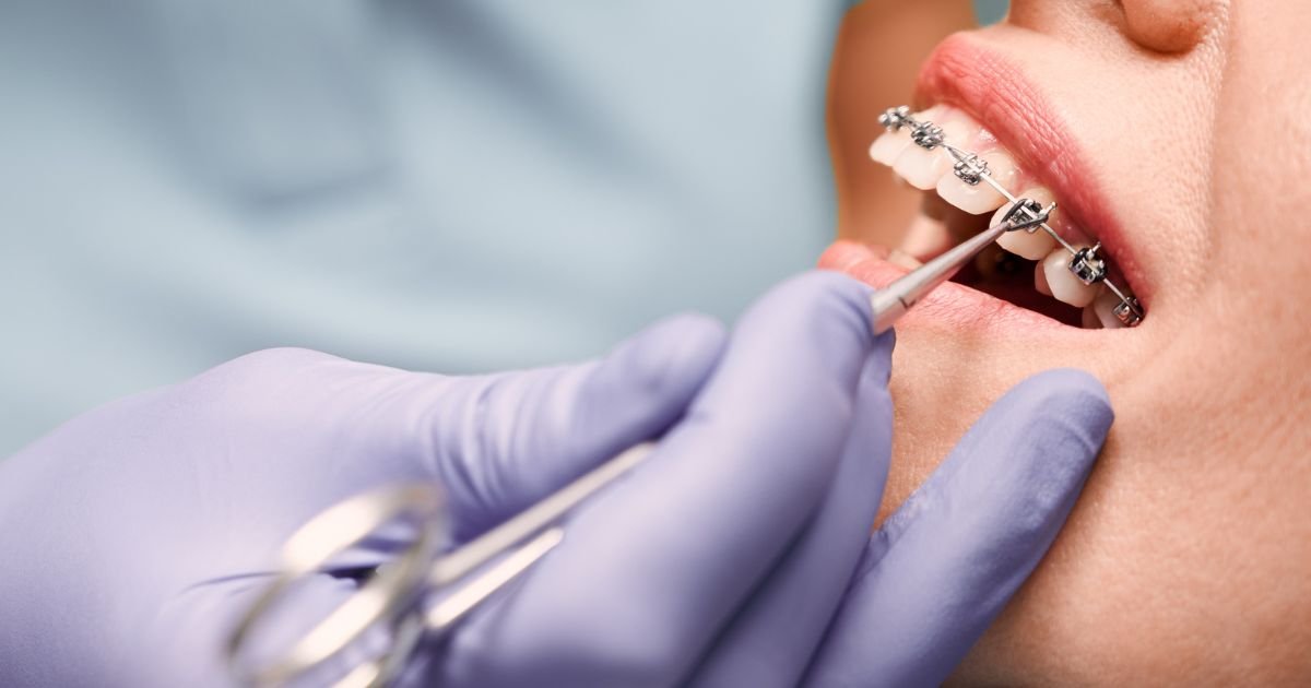 Orthodontist